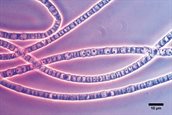 Kabelbacteriën kleur 800px