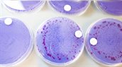 isolatieschalen bacteriekweek onderzoek ralstonia 800px
